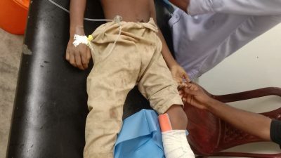 উখিয়ার পালংখালীতে বেপরোয়া ডাম্পারের ধাক্কায় শিশুর মর্মান্তিক মৃত্যু