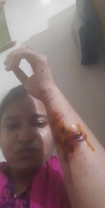 খিলগাঁওয়ে গৃহবধূ ও তার পরিবারের উপর বর্বর হামলা, মিথ্যা মামলা ও হয়রানির অভিযোগ 