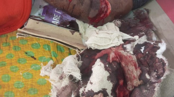 দেবহাটায় এক যুবককে জোরপূর্বক তুলে নিয়ে অমানুষিক নির্যাতন, Debhata youth torture Satkhira